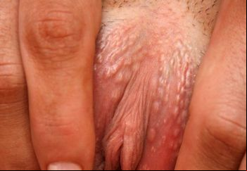 showing pink